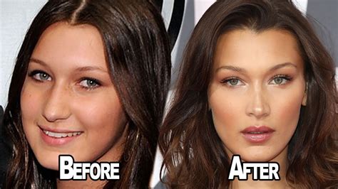 bella hadid before and after.